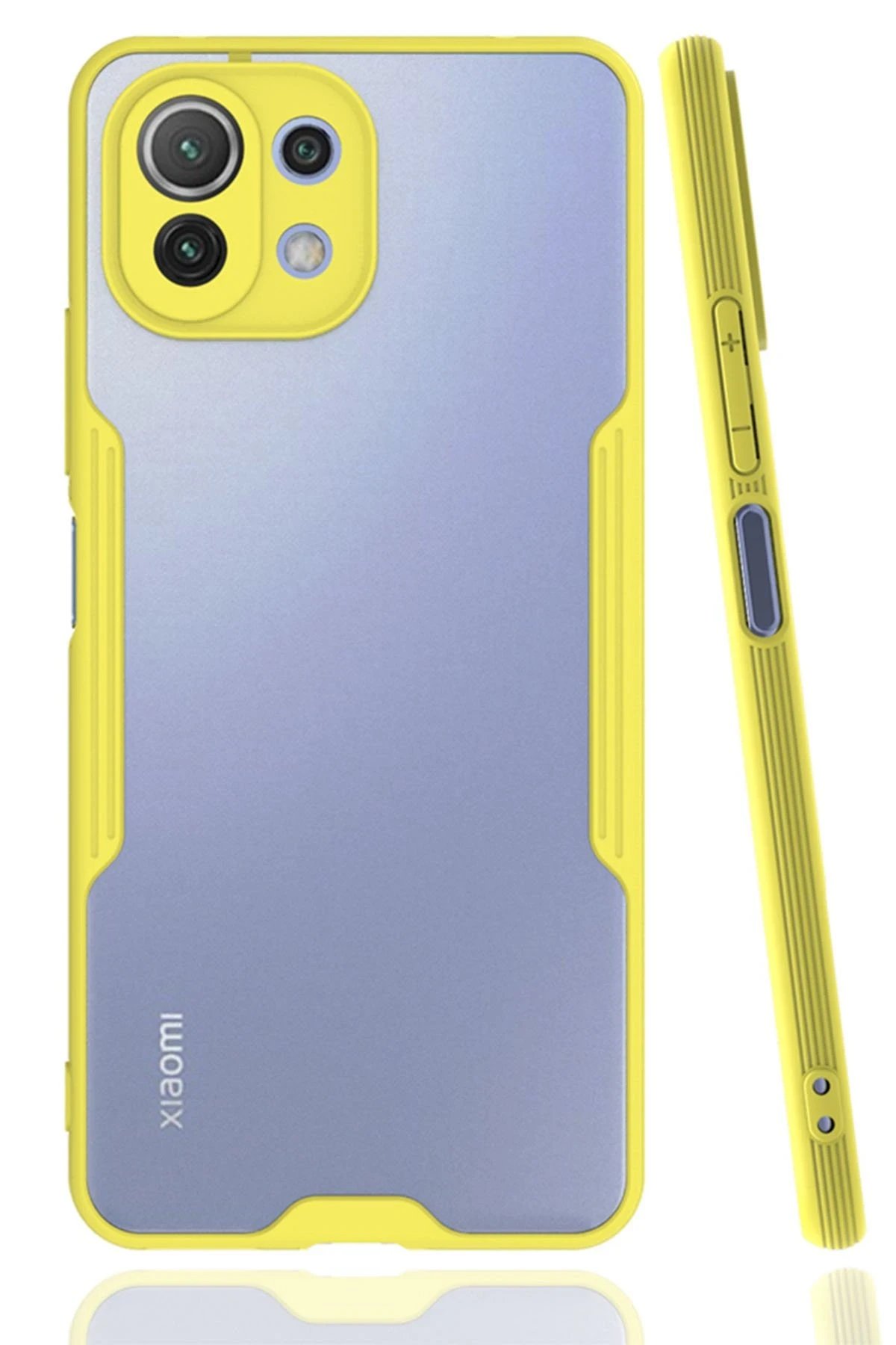 Xiaomi Mİ 11 Lite Kılıf Platin Silikon - Sarı-(5796)